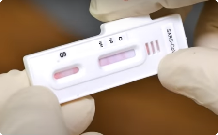 Antigenní test na přítomnost koronaviru